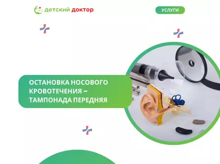 Остановка носового кровотечения – тампонада передняя
